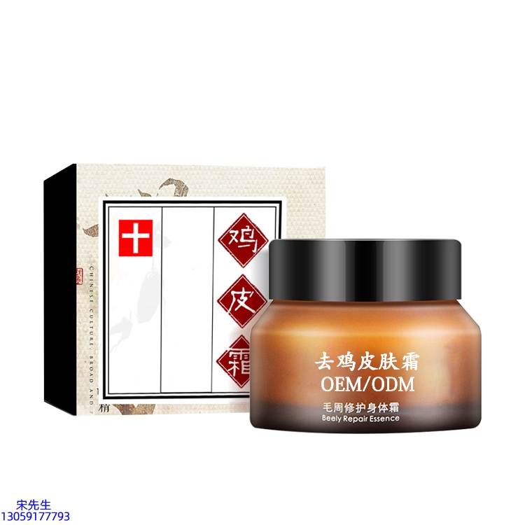 盐城市_去鸡皮肤毛刺毛角周滋润修复保湿身体霜